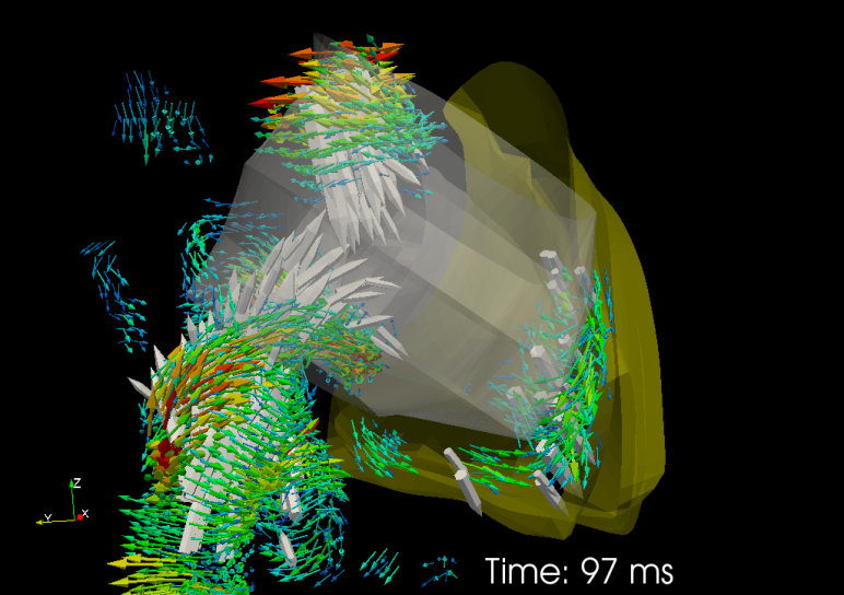 Flow enters the right cardiac atrium from above and below, bringing wall generated vorticity with it.